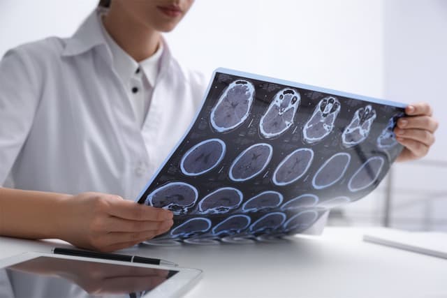 Epilepsi Nedir? Epilepsi Hastaları Nelere Dikkat Etmelidir?